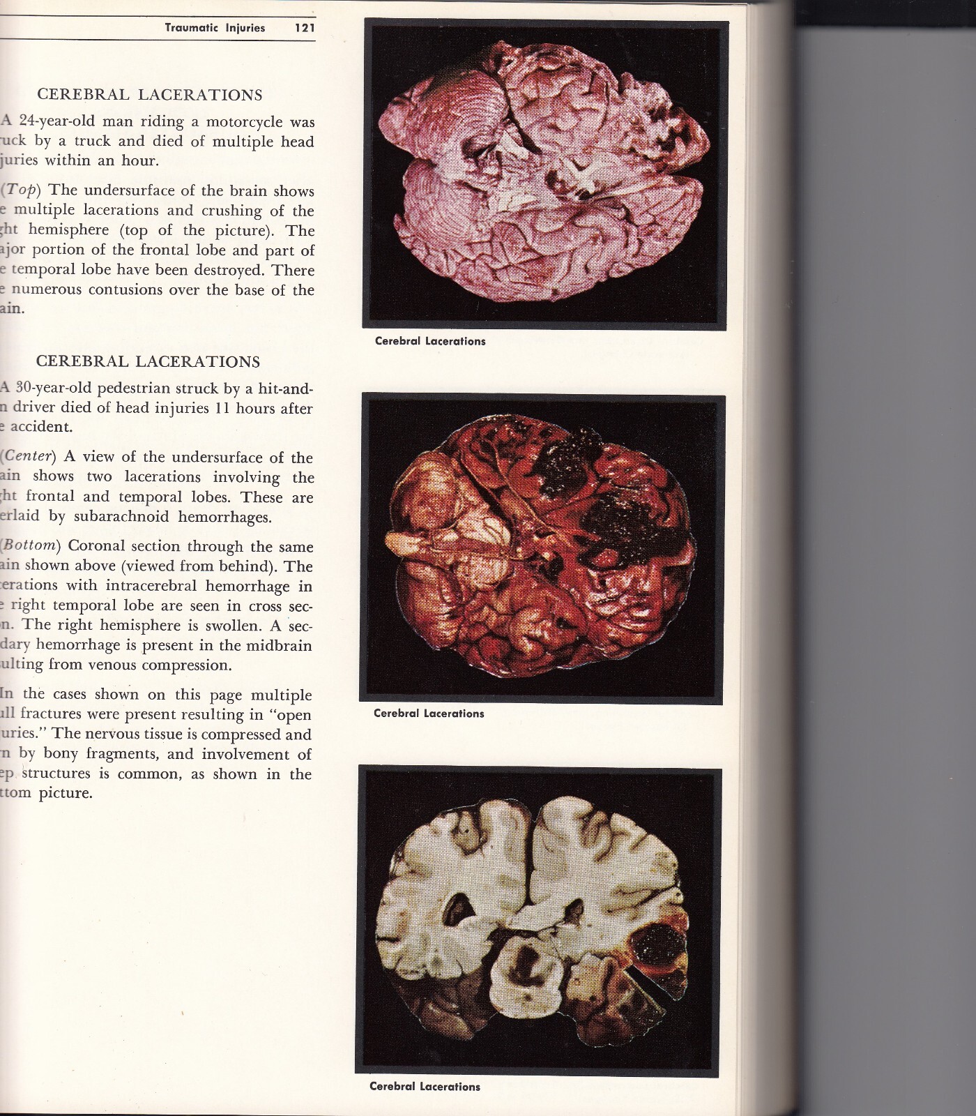 Color Atlas of Pathology Vol. I, II & III