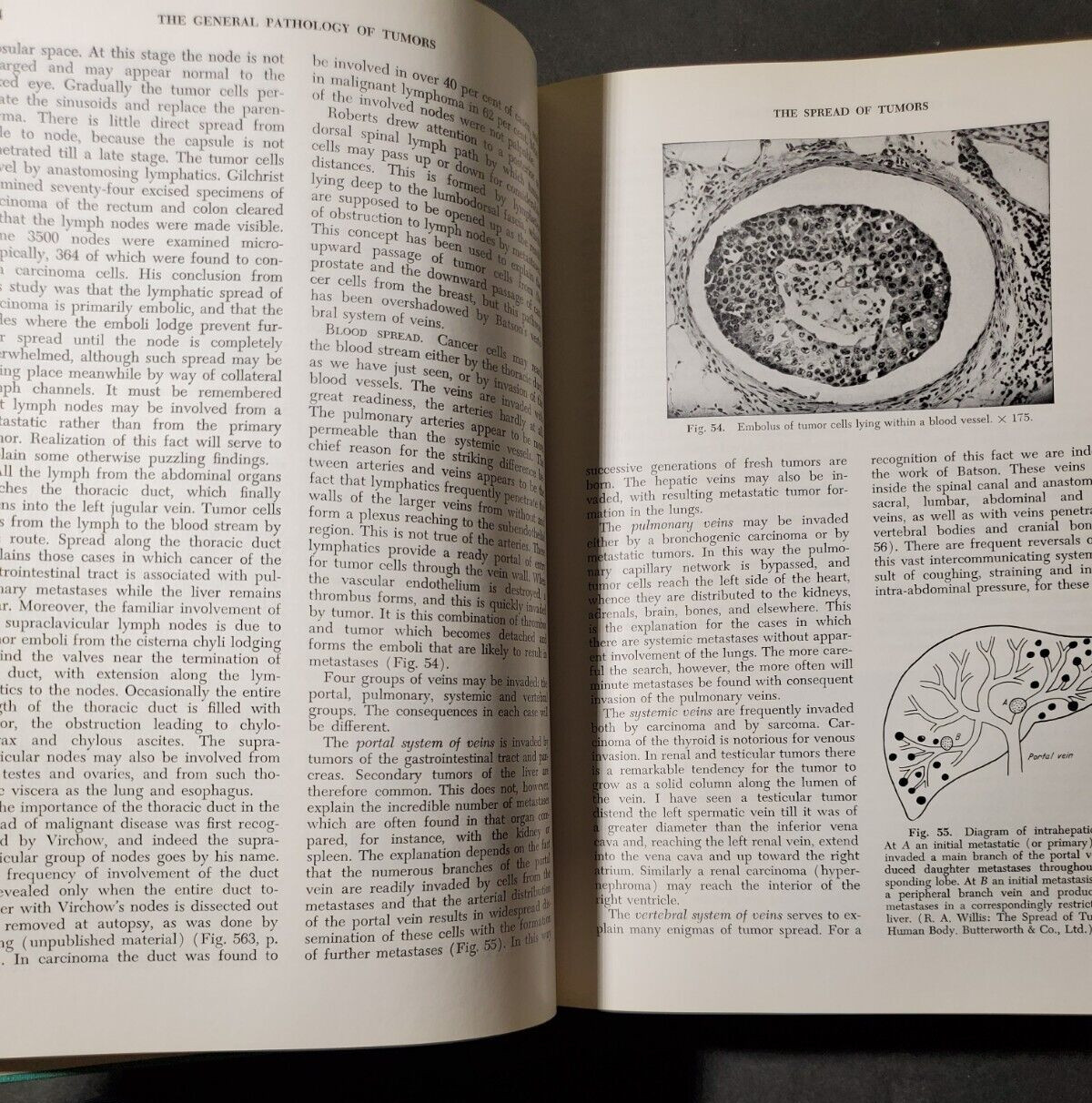 BOYD’S PATHOLOGY FOR THE SURGEON 8th Ed.by William Anderson 1967 HC Saunders