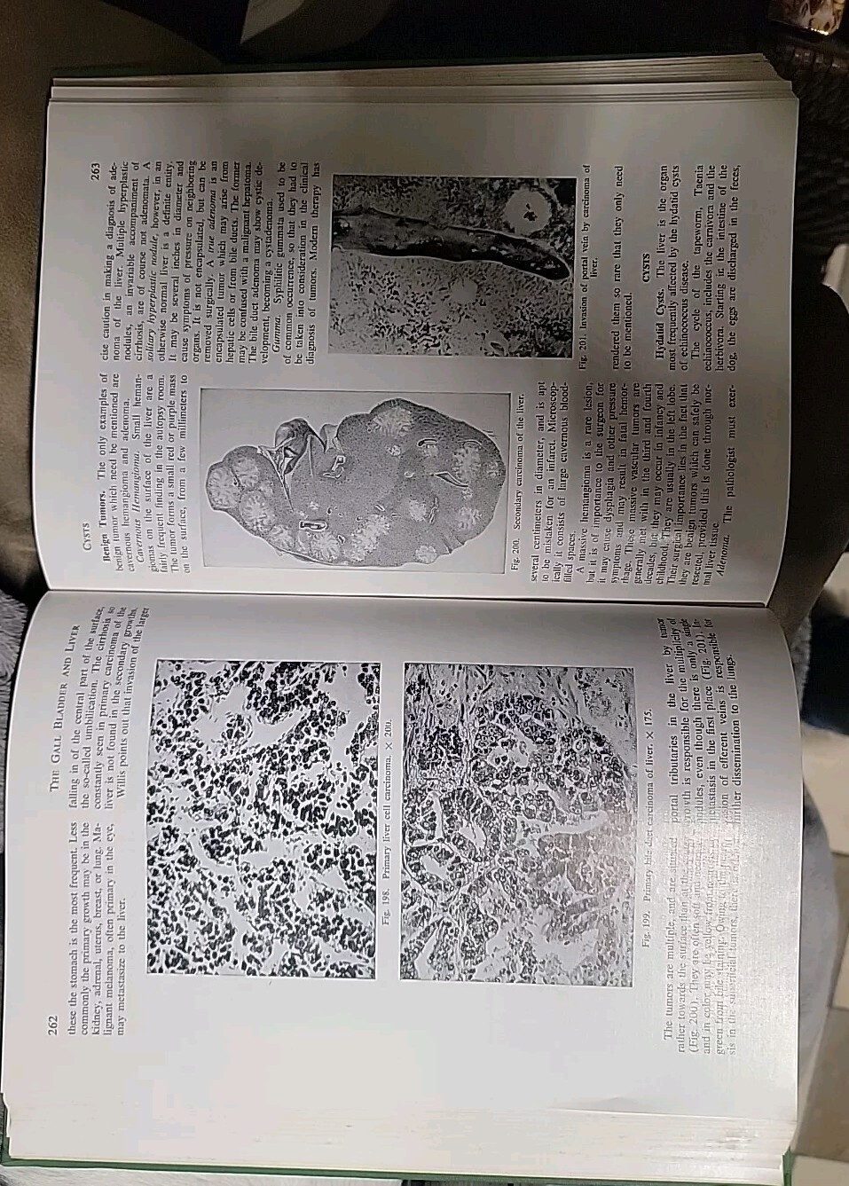 Vtg 1955 Hardcover Pathology for the Surgeon William Boyd 7th Edition Saunders