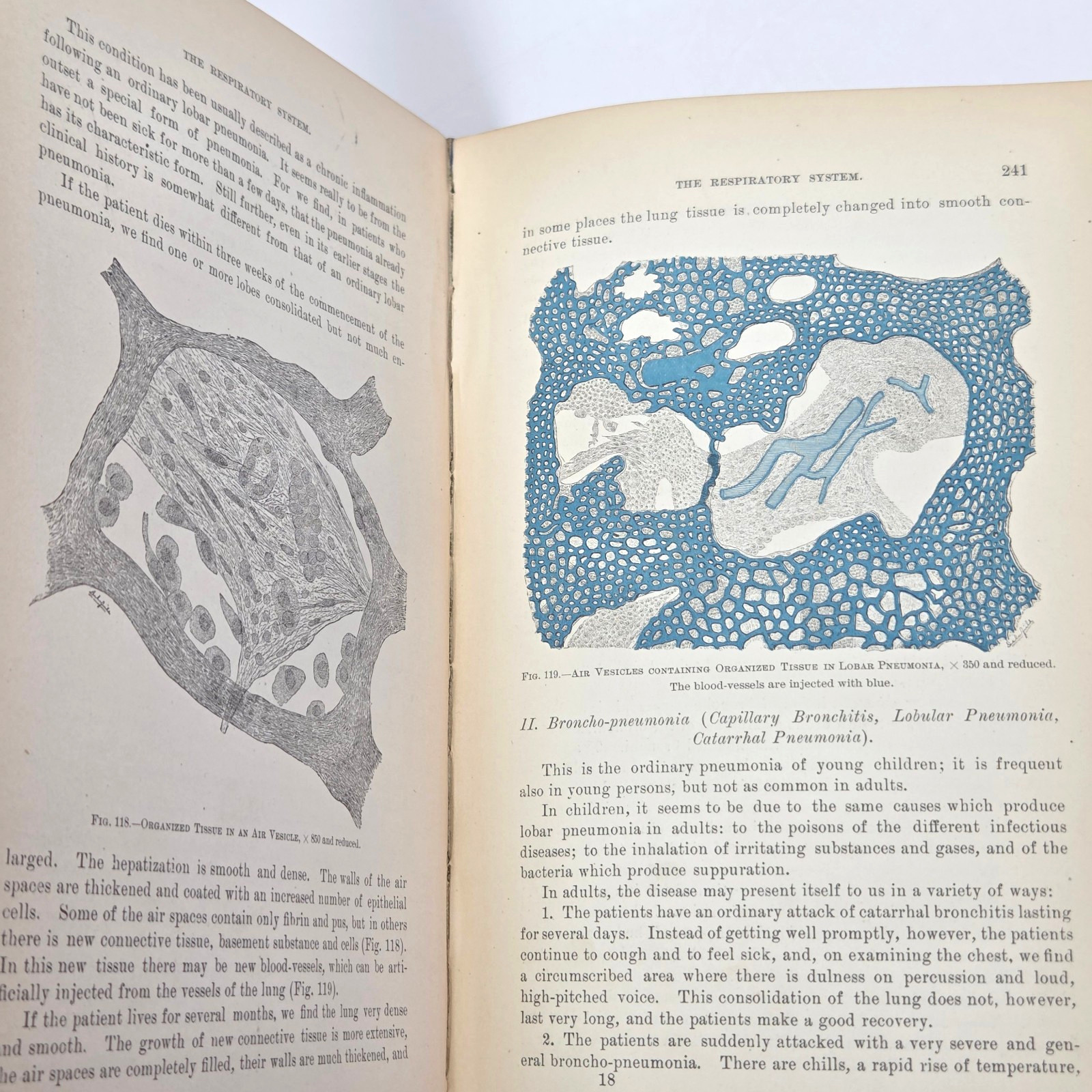 Handbook Pathological Anatomy Histology Delafield Prudden 1889 HC Wood Engraving