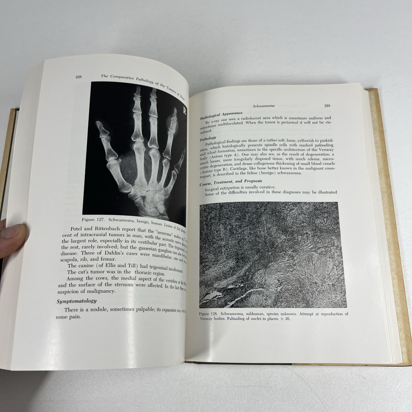 Comparative Pathology of the Tumors of Bone by Jacobson 1971 CSI Vintage Medical