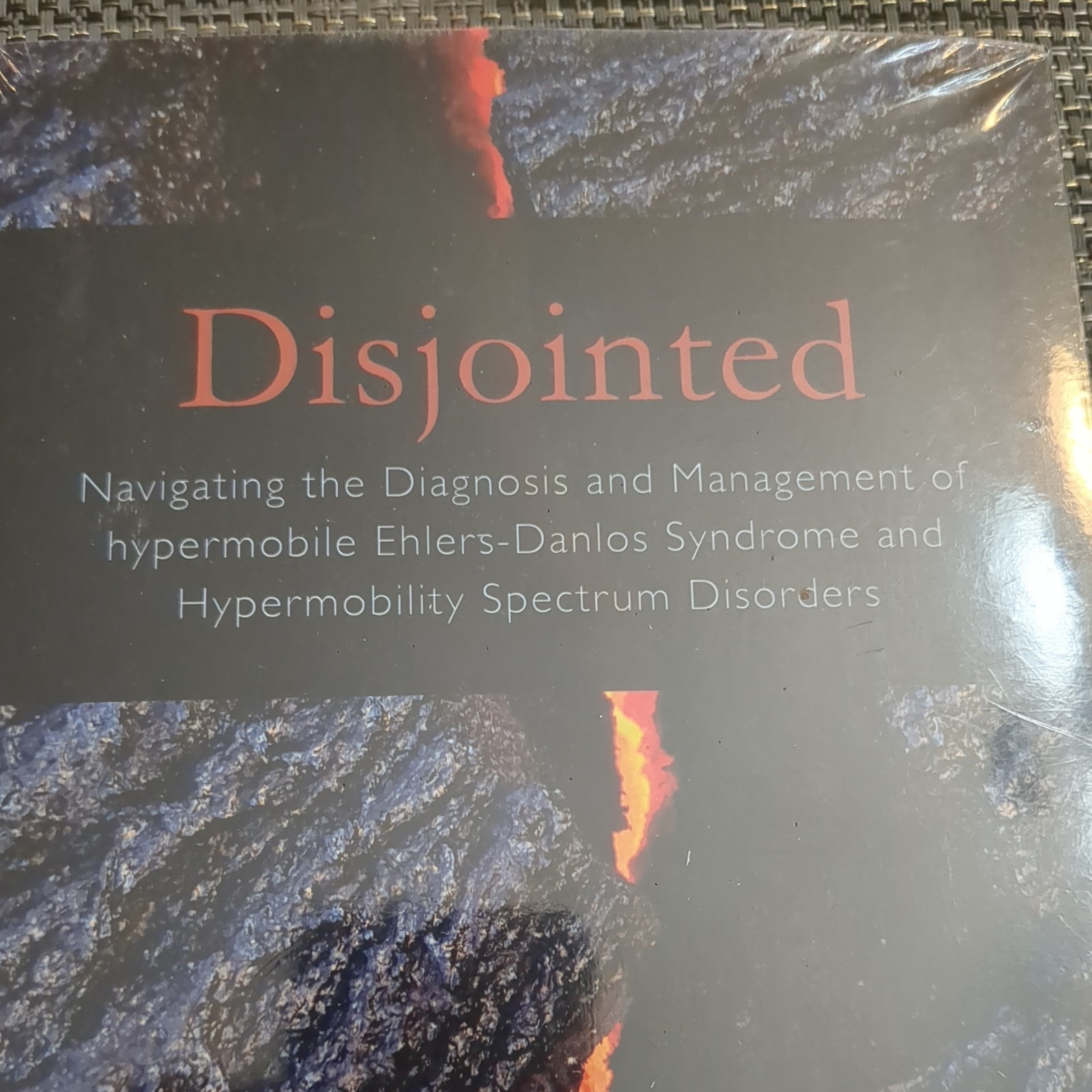 Disjointed : Navigating the Diagnosis and Management of Hypermobile, Jovin