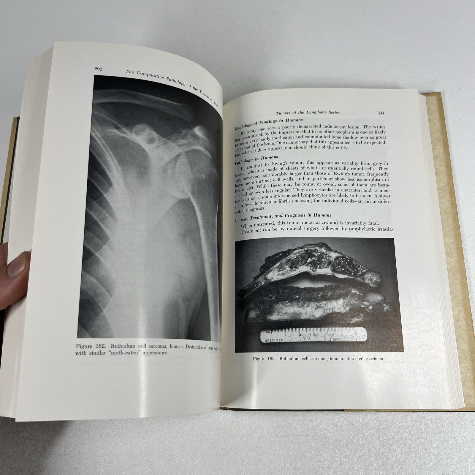 Comparative Pathology of the Tumors of Bone by Jacobson 1971 CSI Vintage Medical