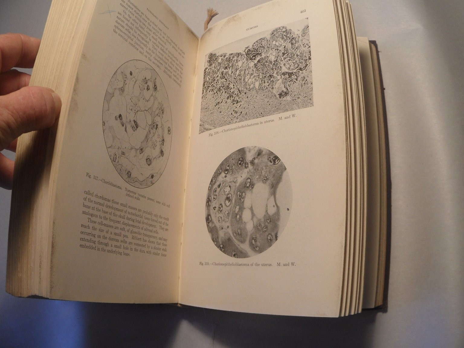 Principles of Pathologic Histology Mallory 1918 Medical Textbook Illustrated
