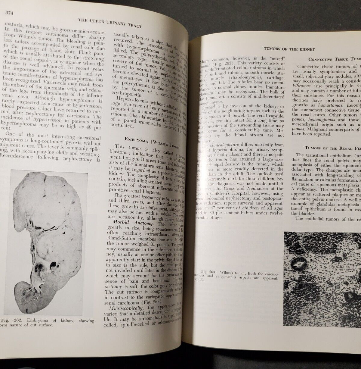 BOYD’S PATHOLOGY FOR THE SURGEON 8th Ed.by William Anderson 1967 HC Saunders
