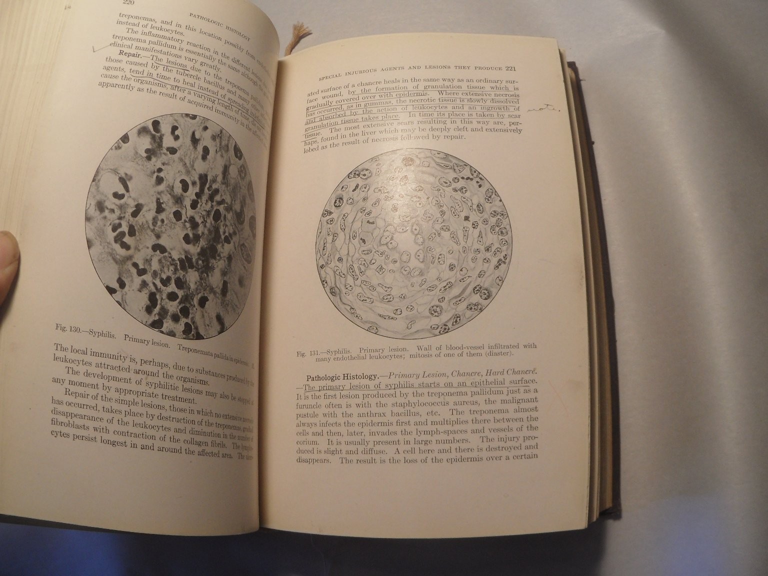 Principles of Pathologic Histology Mallory 1918 Medical Textbook Illustrated