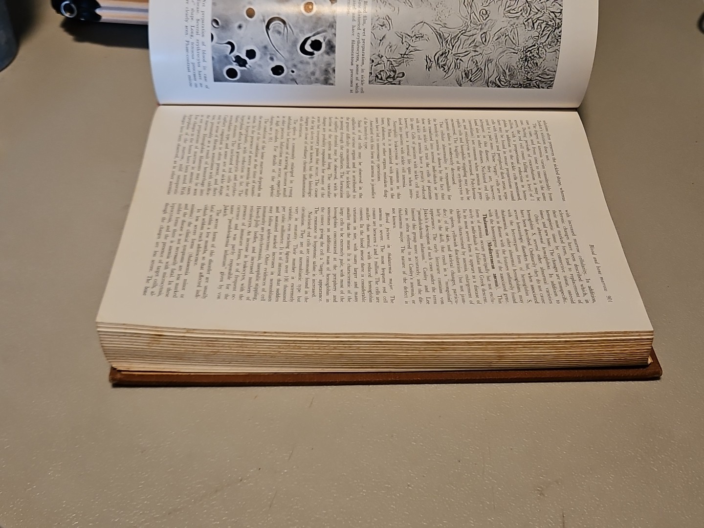 Pathology by W.A.D. Anderson 4th Edition HC Mosby 1961
