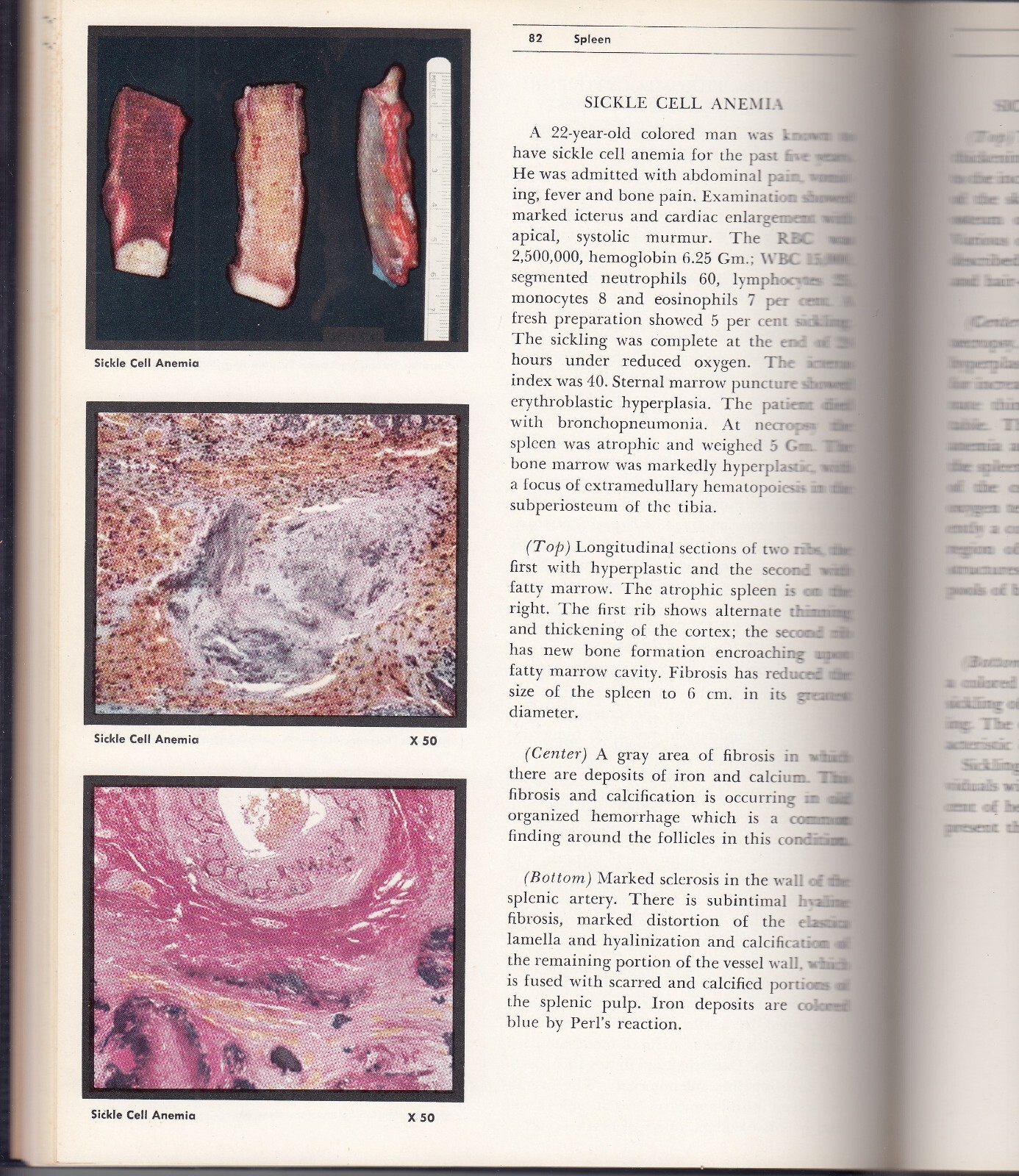 Color Atlas of Pathology Vol. I, II & III