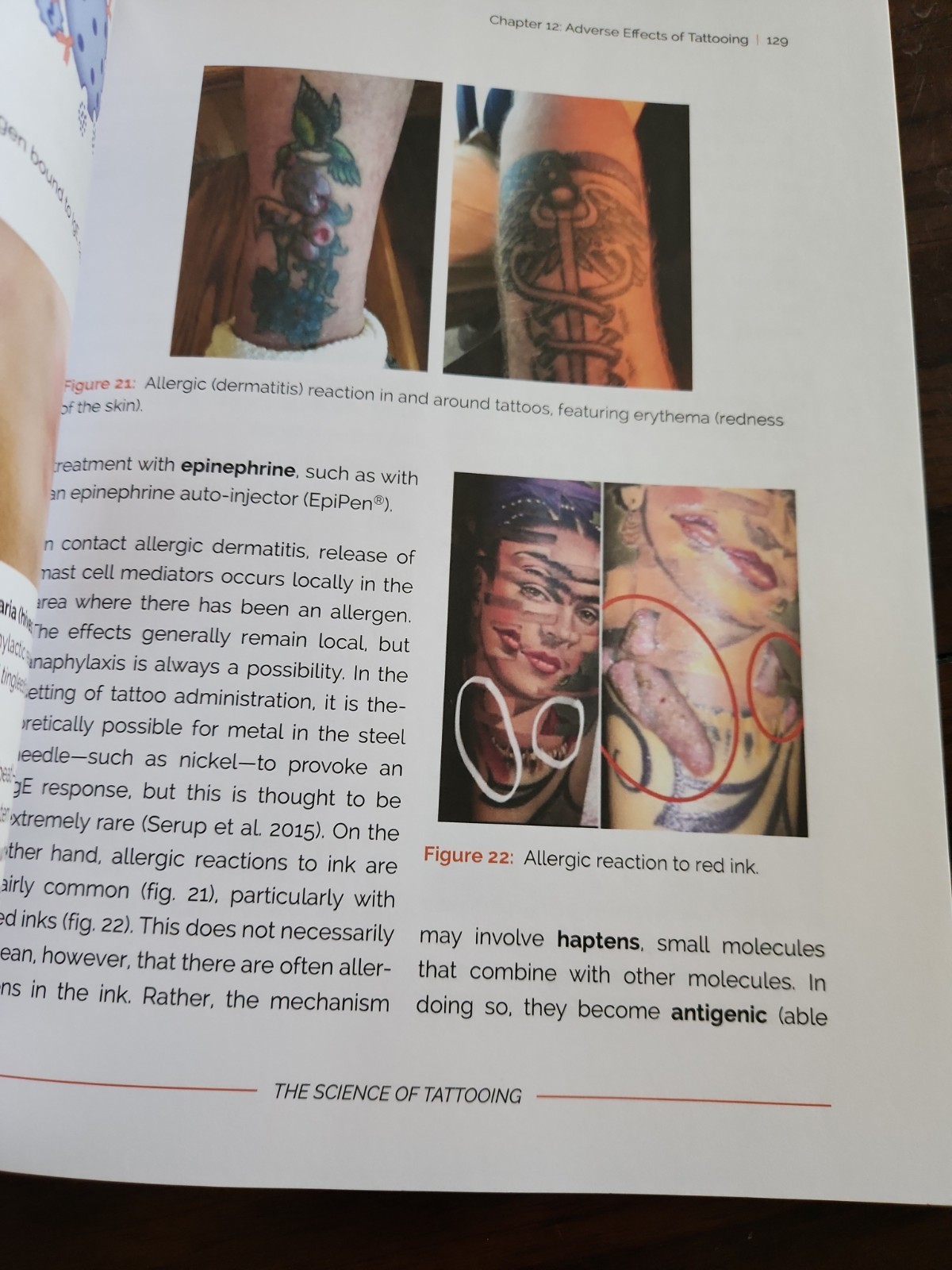 The Science of Tattooing by Warmflash, David, Used VG Condition