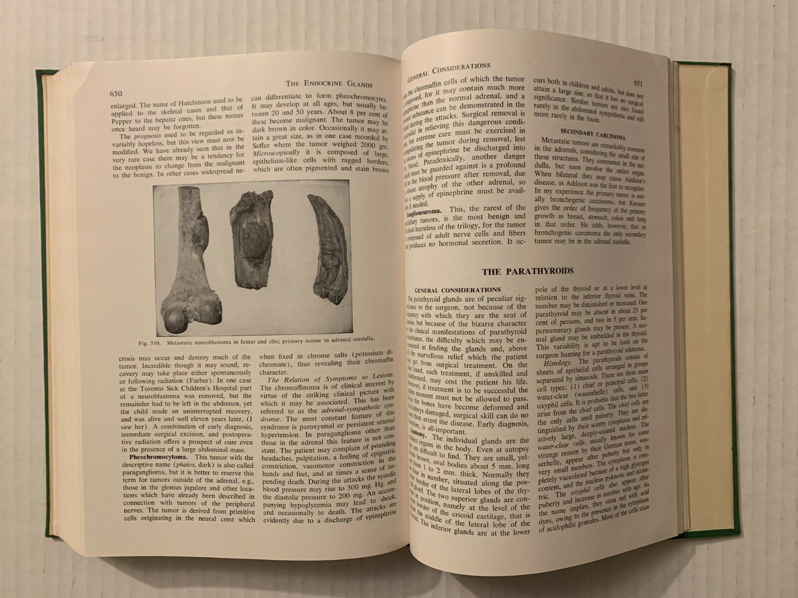 Vtg 1955 Hardcover Pathology for the Surgeon William Boyd 7th Edition Saunders