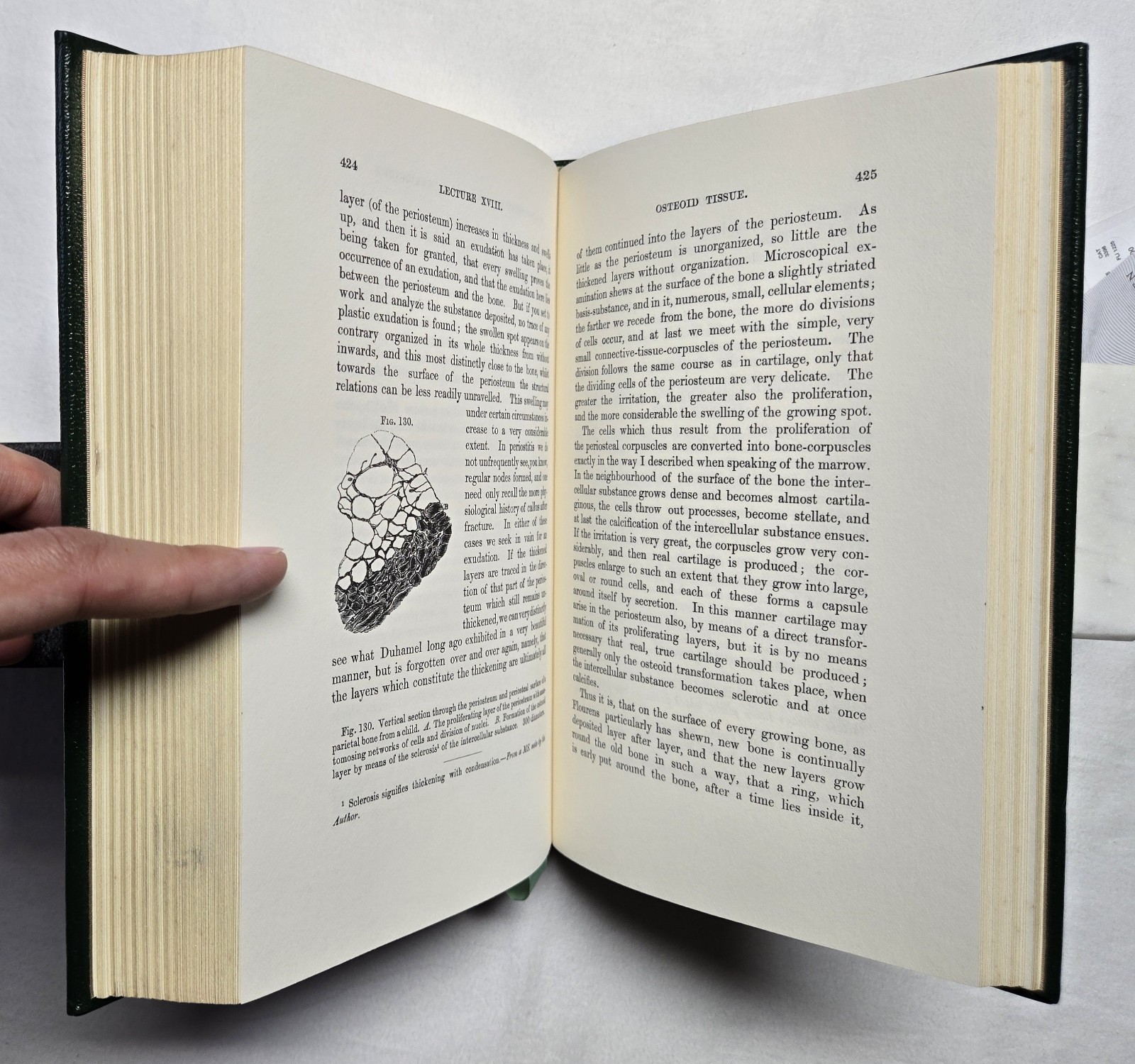 Cellular Pathology by Rudolph Virchow (The Classics of Medicine Library) 1978