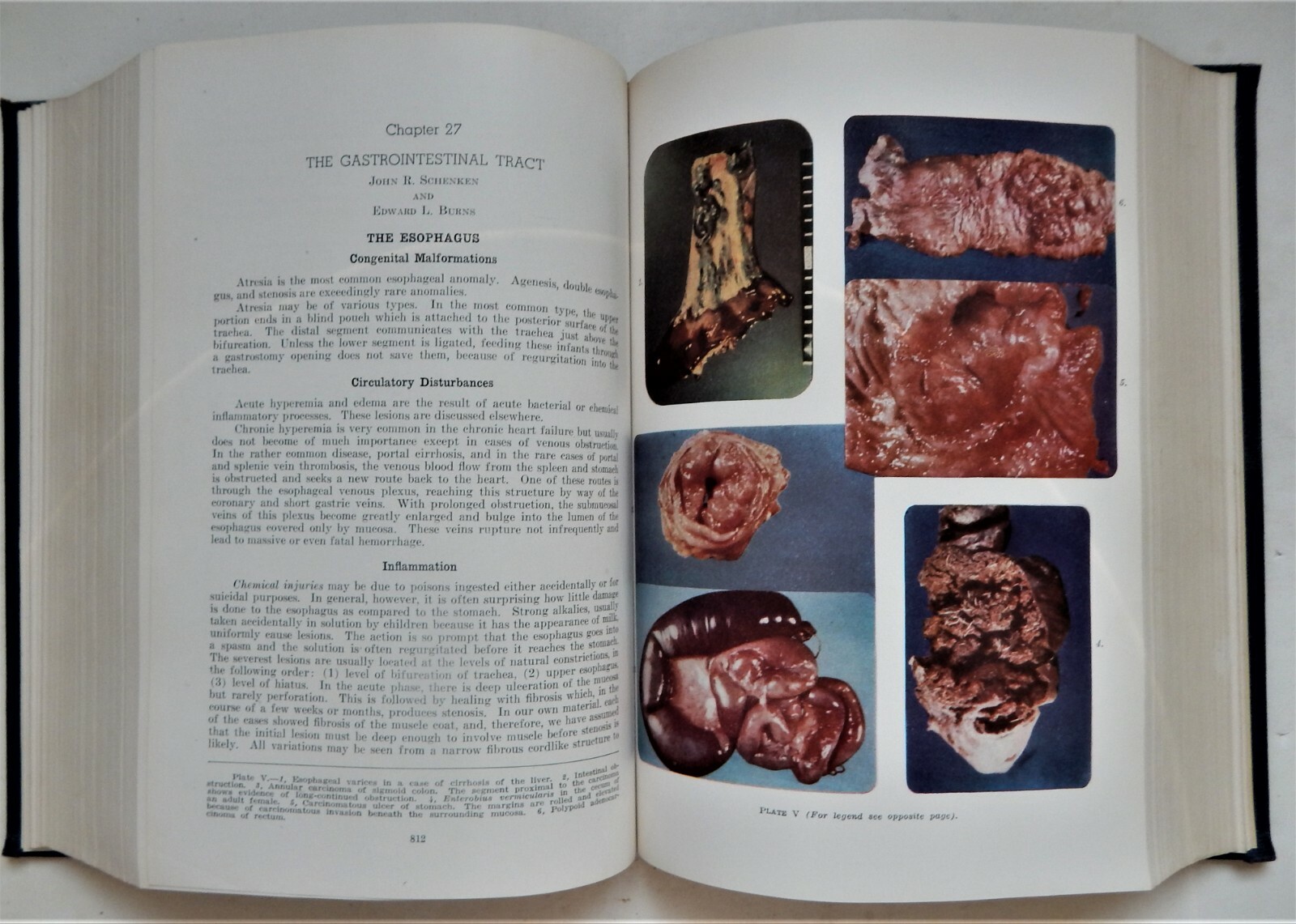 Pathology W A D Anderson 1948 1E Medical MD vintage reference disease photos