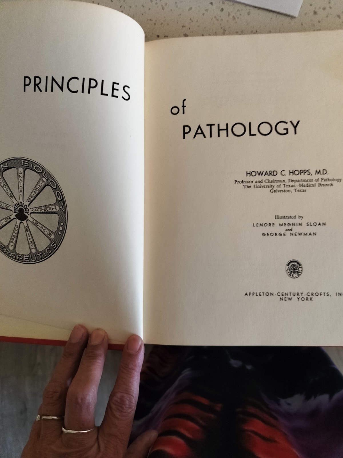 Howard C. Hopps Principles of Pathology Appleton-Century-Crofts Hardcover 1959