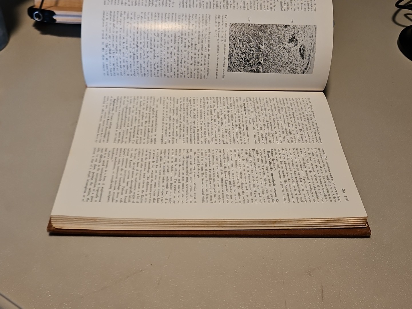 Pathology by W.A.D. Anderson 4th Edition HC Mosby 1961