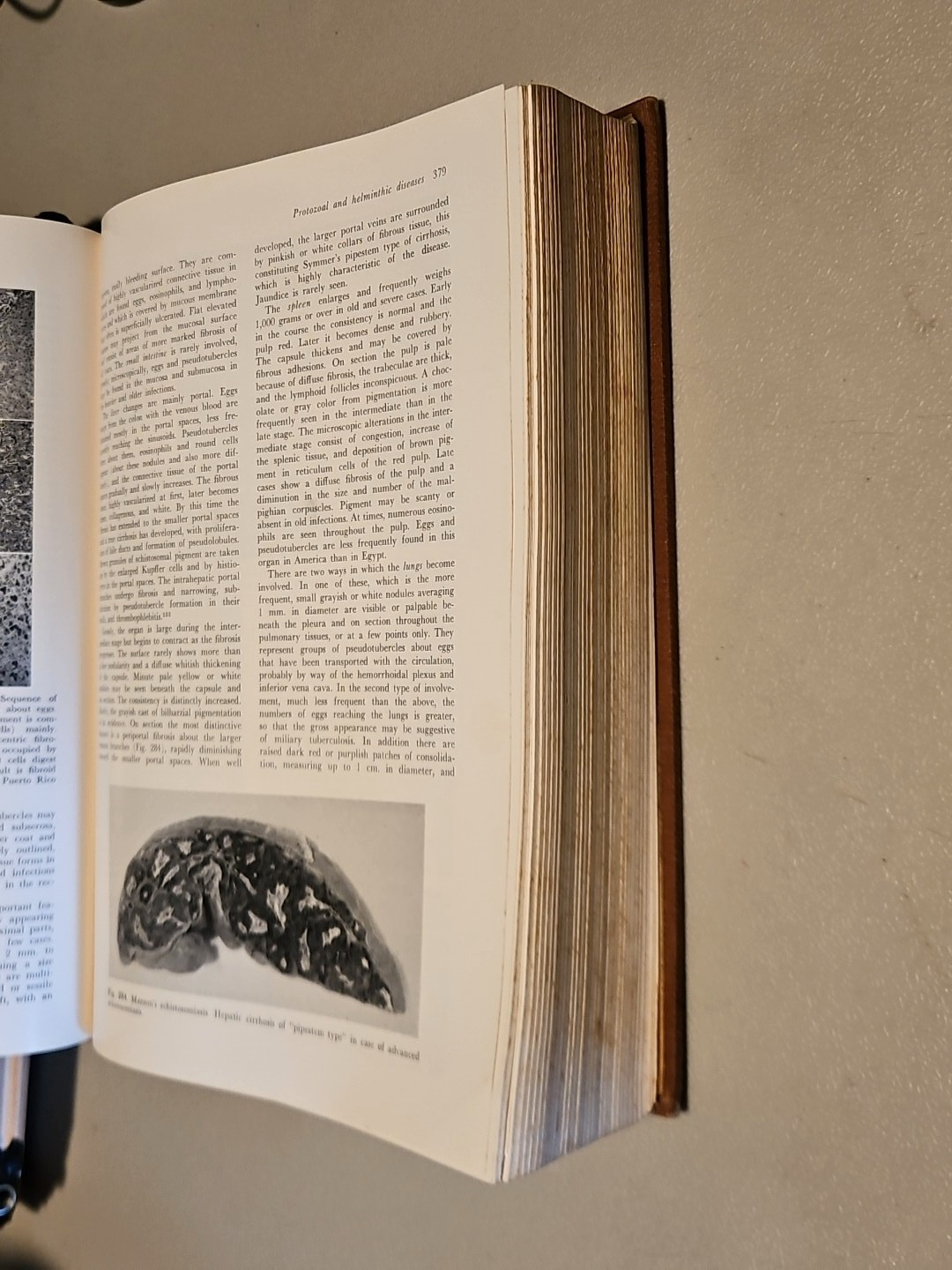 Pathology by W.A.D. Anderson 4th Edition HC Mosby 1961