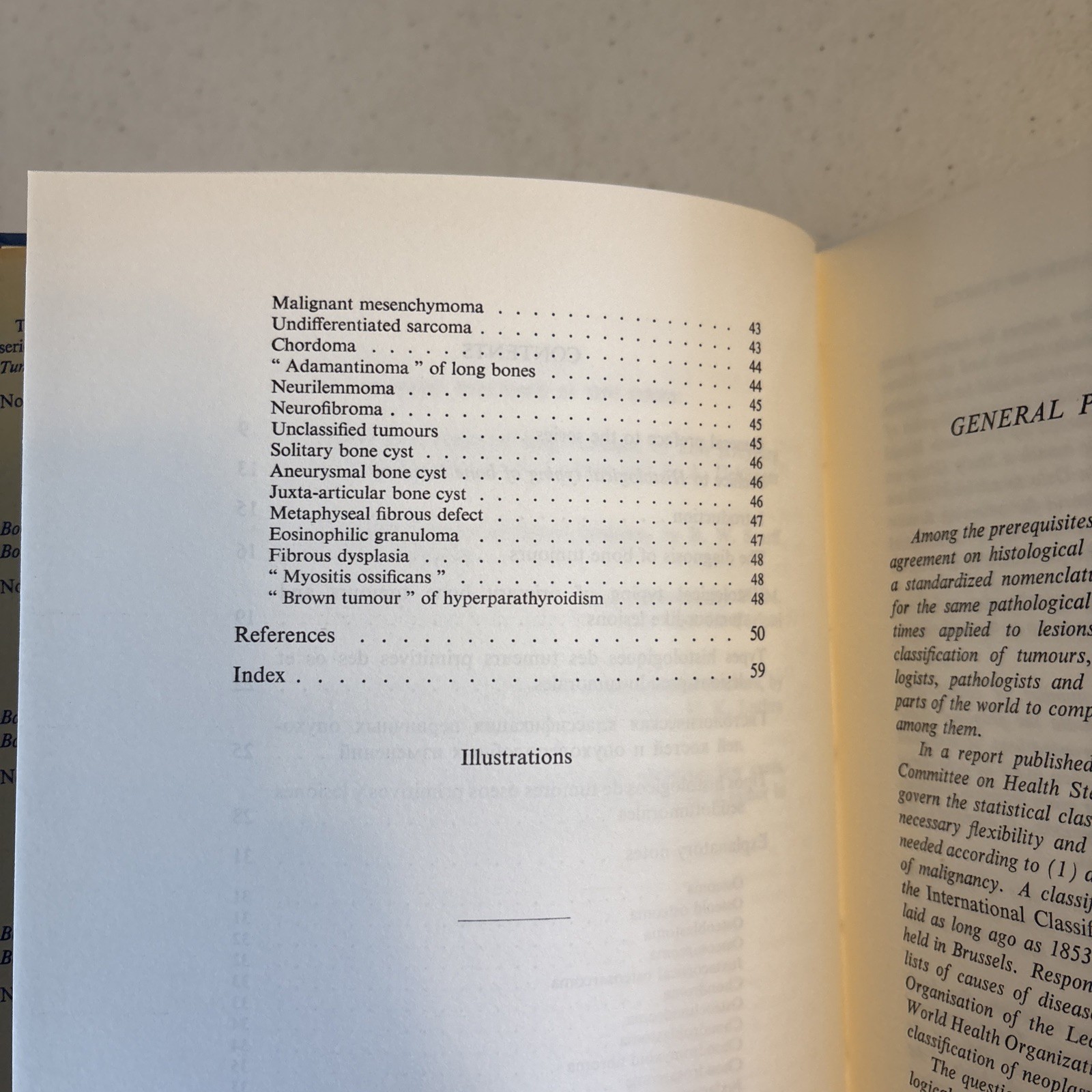 Histological Typing of Bone Tumours (1972) – WHO – Hardcover Medical Pathology