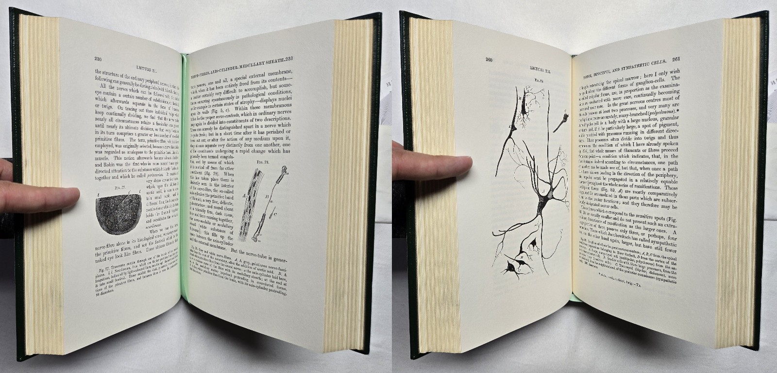 Cellular Pathology by Rudolph Virchow (The Classics of Medicine Library) 1978